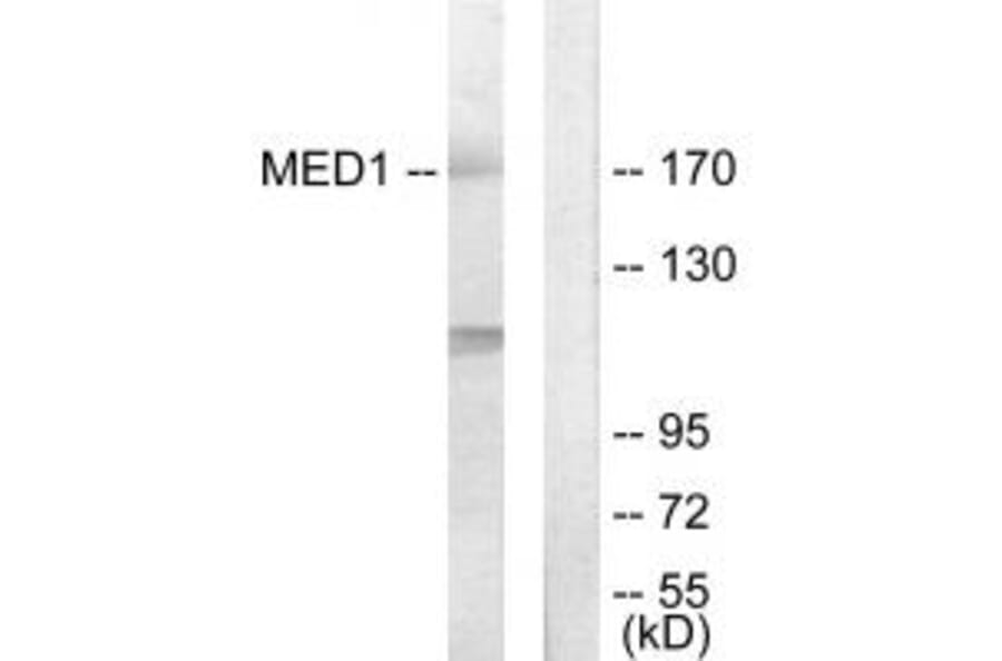 Western blot - MED1 Antibody from Signalway Antibody (33902) - Antibodies.com