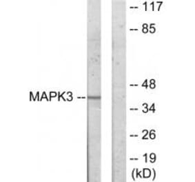 Western blot - MAPK3 Antibody from Signalway Antibody (33912) - Antibodies.com