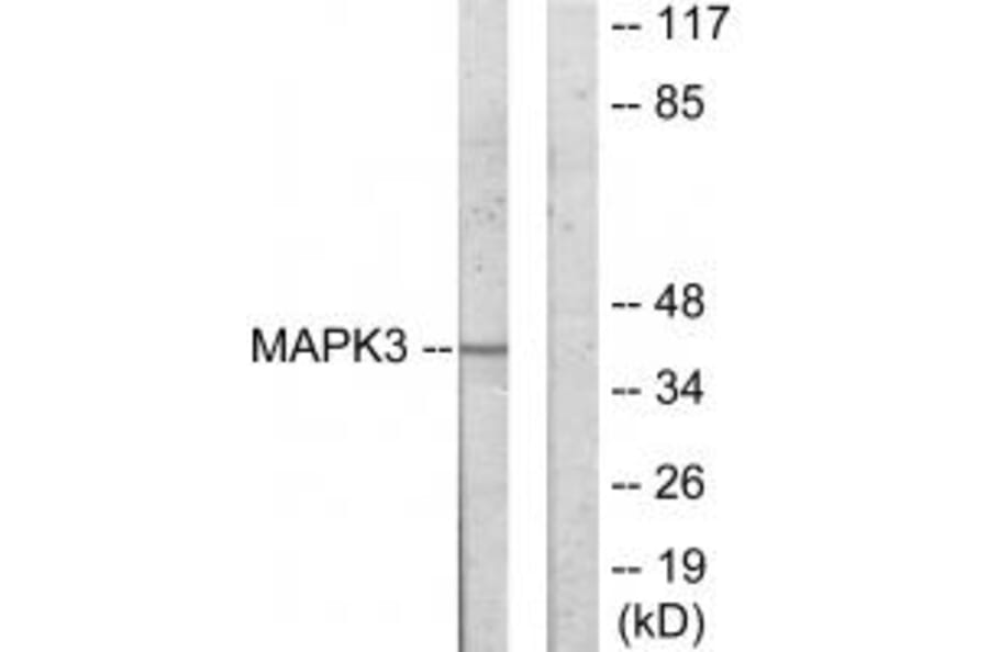 Western blot - MAPK3 Antibody from Signalway Antibody (33912) - Antibodies.com
