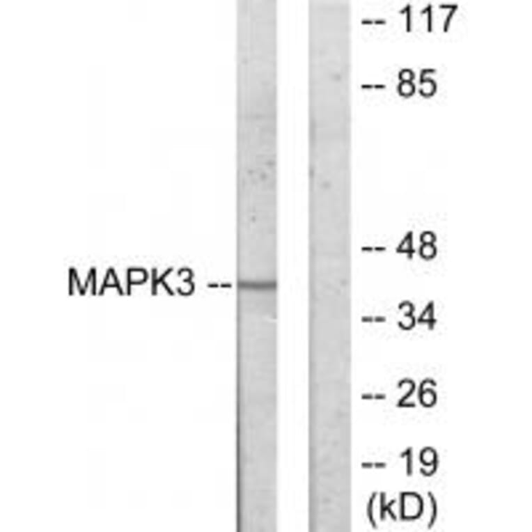 Western blot - MAPK3 Antibody from Signalway Antibody (33912) - Antibodies.com