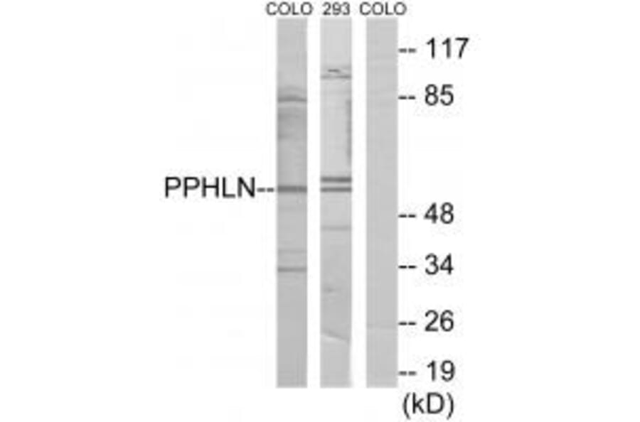 Western blot - PPHLN Antibody from Signalway Antibody (33975) - Antibodies.com