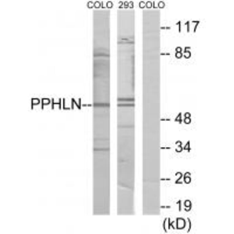 Western blot - PPHLN Antibody from Signalway Antibody (33975) - Antibodies.com