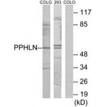 Western blot - PPHLN Antibody from Signalway Antibody (33975) - Antibodies.com