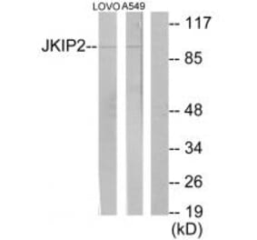 Western blot - JKIP2 Antibody from Signalway Antibody (34023) - Antibodies.com