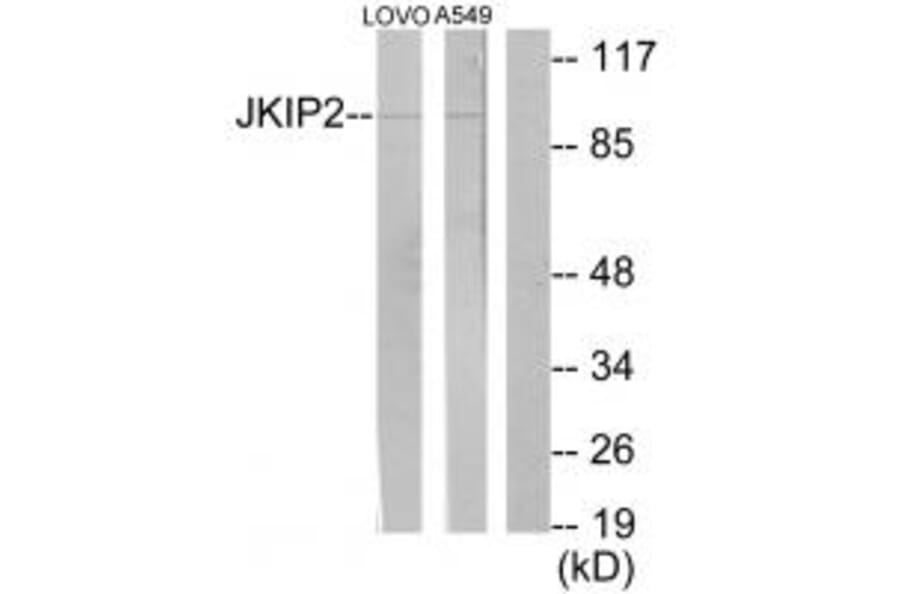 Western blot - JKIP2 Antibody from Signalway Antibody (34023) - Antibodies.com