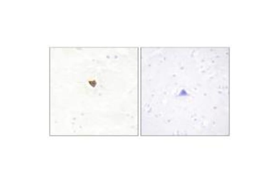 Immunohistochemistry - JKIP2 Antibody from Signalway Antibody (34023) - Antibodies.com