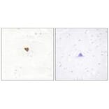 Immunohistochemistry - JKIP2 Antibody from Signalway Antibody (34023) - Antibodies.com