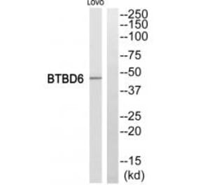 Western blot - BTBD6 Antibody from Signalway Antibody (34032) - Antibodies.com