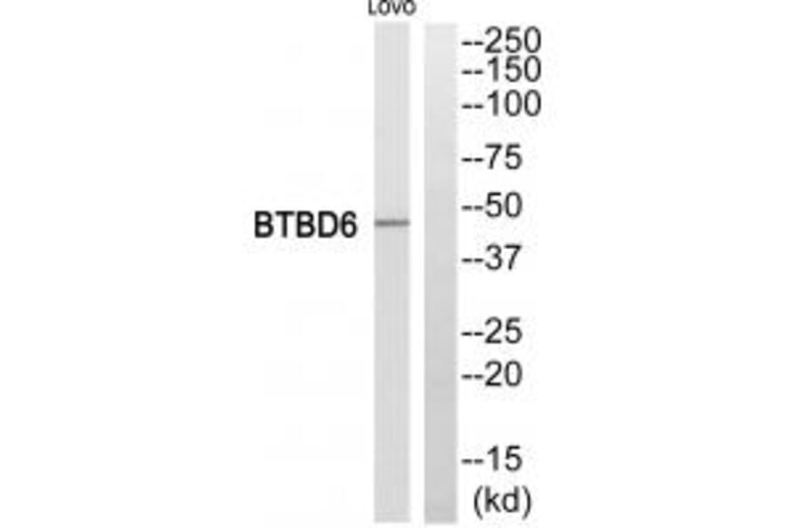 Western blot - BTBD6 Antibody from Signalway Antibody (34032) - Antibodies.com