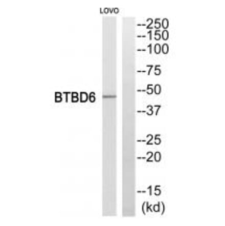 Western blot - BTBD6 Antibody from Signalway Antibody (34032) - Antibodies.com