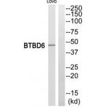 Western blot - BTBD6 Antibody from Signalway Antibody (34032) - Antibodies.com