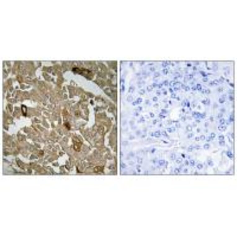 Immunohistochemistry - BTBD6 Antibody from Signalway Antibody (34032) - Antibodies.com