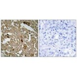 Immunohistochemistry - BTBD6 Antibody from Signalway Antibody (34032) - Antibodies.com
