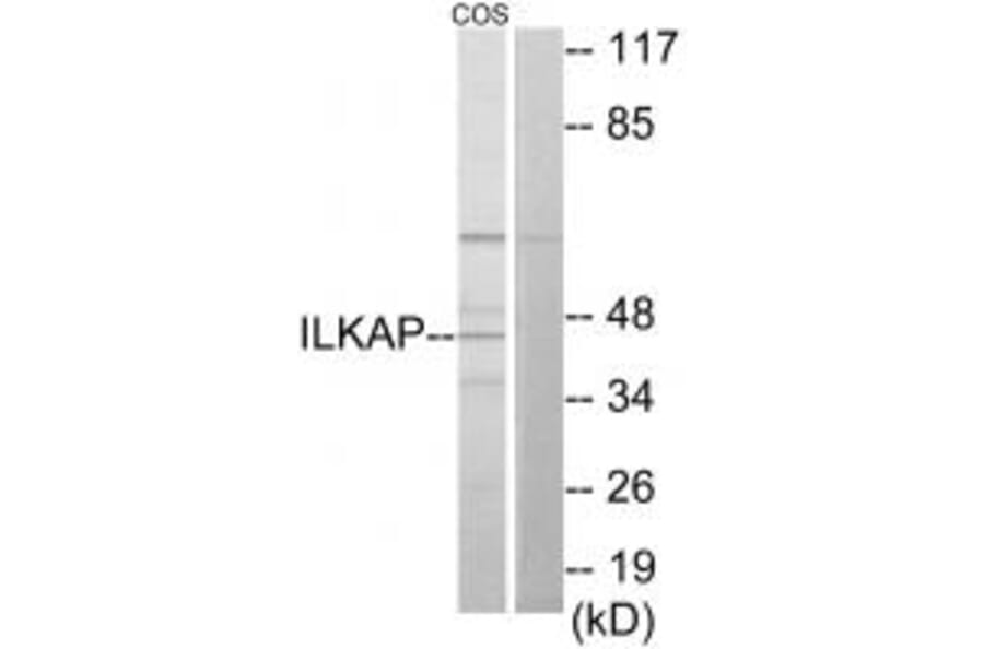 Western blot - ILKAP Antibody from Signalway Antibody (34057) - Antibodies.com