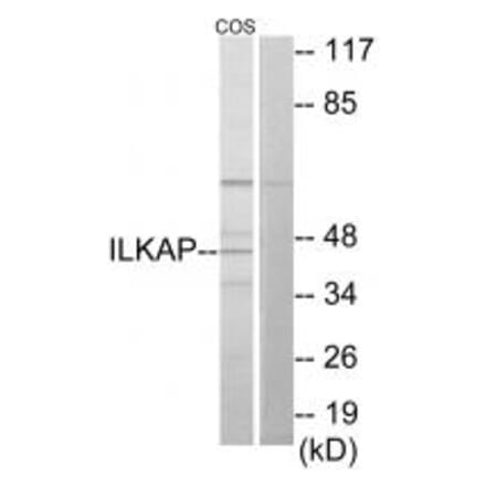 Western blot - ILKAP Antibody from Signalway Antibody (34057) - Antibodies.com