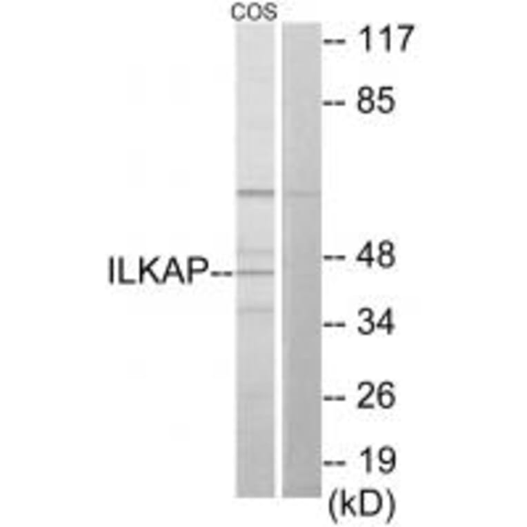 Western blot - ILKAP Antibody from Signalway Antibody (34057) - Antibodies.com