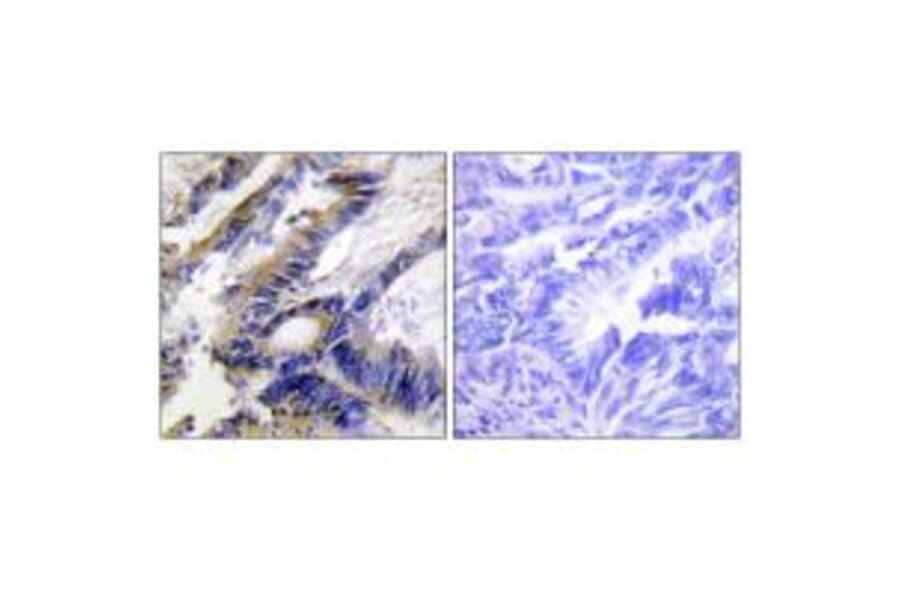 Immunohistochemistry - ILKAP Antibody from Signalway Antibody (34057) - Antibodies.com
