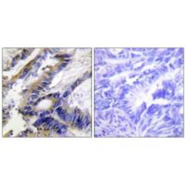 Immunohistochemistry - ILKAP Antibody from Signalway Antibody (34057) - Antibodies.com
