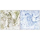 Immunohistochemistry - BCOR Antibody from Signalway Antibody (34170) - Antibodies.com