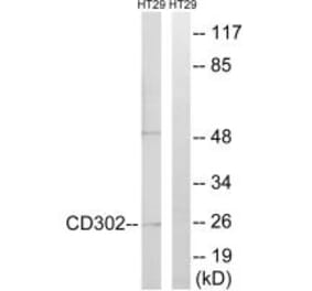 Western blot - CD302 Antibody from Signalway Antibody (34188) - Antibodies.com
