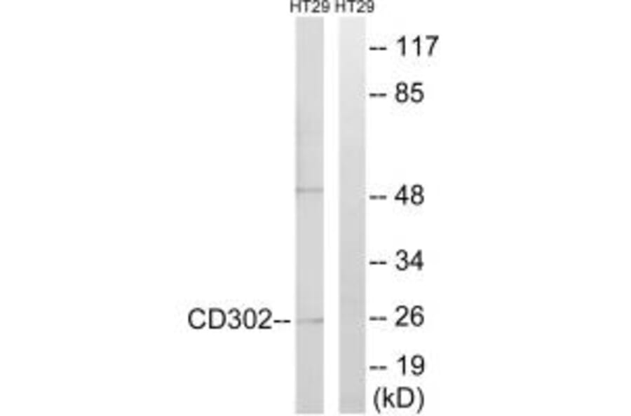 Western blot - CD302 Antibody from Signalway Antibody (34188) - Antibodies.com