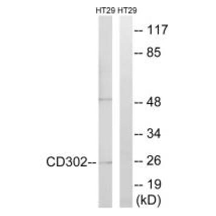 Western blot - CD302 Antibody from Signalway Antibody (34188) - Antibodies.com