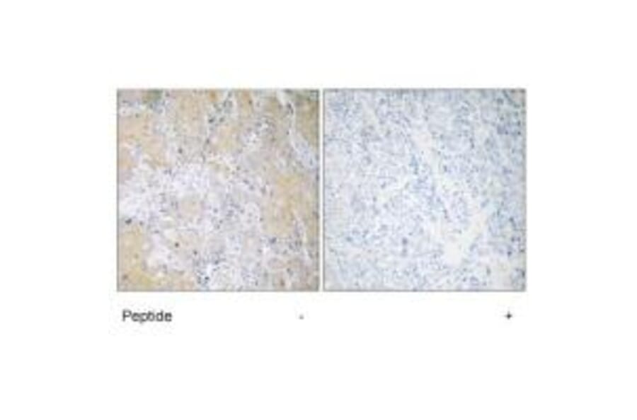 Immunohistochemistry - PSMD3 Antibody from Signalway Antibody (34308) - Antibodies.com