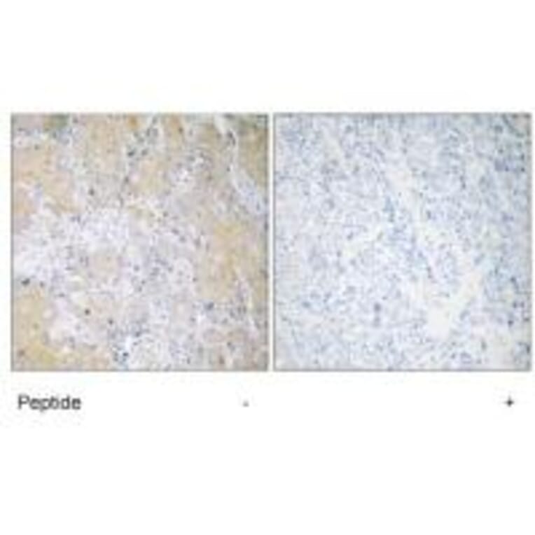 Immunohistochemistry - PSMD3 Antibody from Signalway Antibody (34308) - Antibodies.com