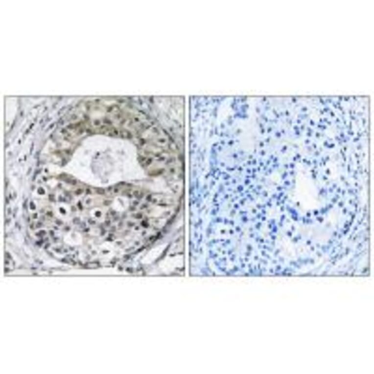 Immunohistochemistry - RPS13 Antibody from Signalway Antibody (34330) - Antibodies.com