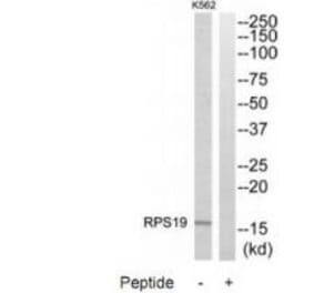 Western blot - RPS19 Antibody from Signalway Antibody (34332) - Antibodies.com