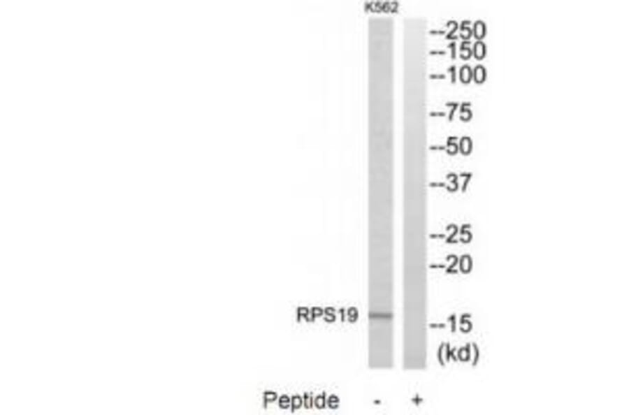 Western blot - RPS19 Antibody from Signalway Antibody (34332) - Antibodies.com