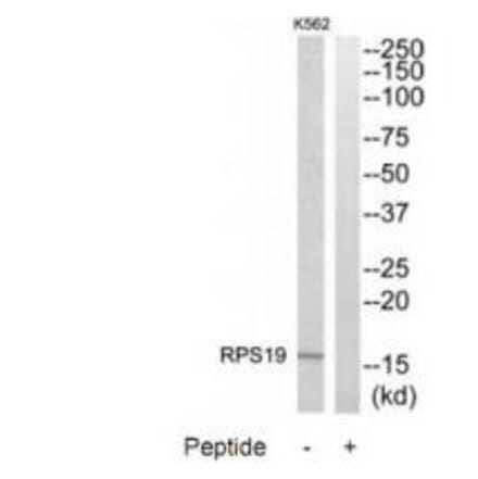 Western blot - RPS19 Antibody from Signalway Antibody (34332) - Antibodies.com