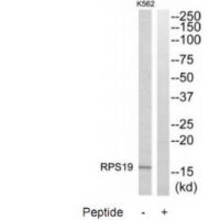 Western blot - RPS19 Antibody from Signalway Antibody (34332) - Antibodies.com