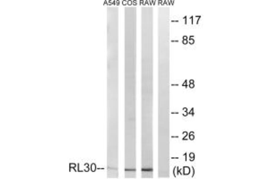 Western blot - RPL30 Antibody from Signalway Antibody (34354) - Antibodies.com