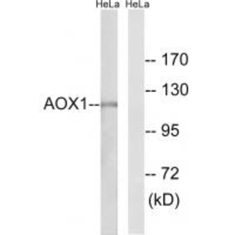 Western blot - AOX1 Antibody from Signalway Antibody (34399) - Antibodies.com