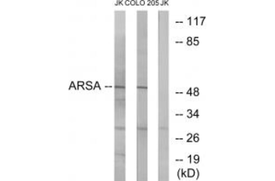 Western blot - ARSA Antibody from Signalway Antibody (34440) - Antibodies.com
