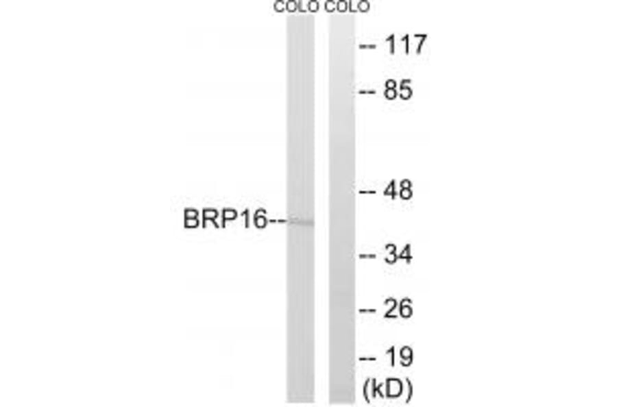 Western blot - BRP16 Antibody from Signalway Antibody (34503) - Antibodies.com