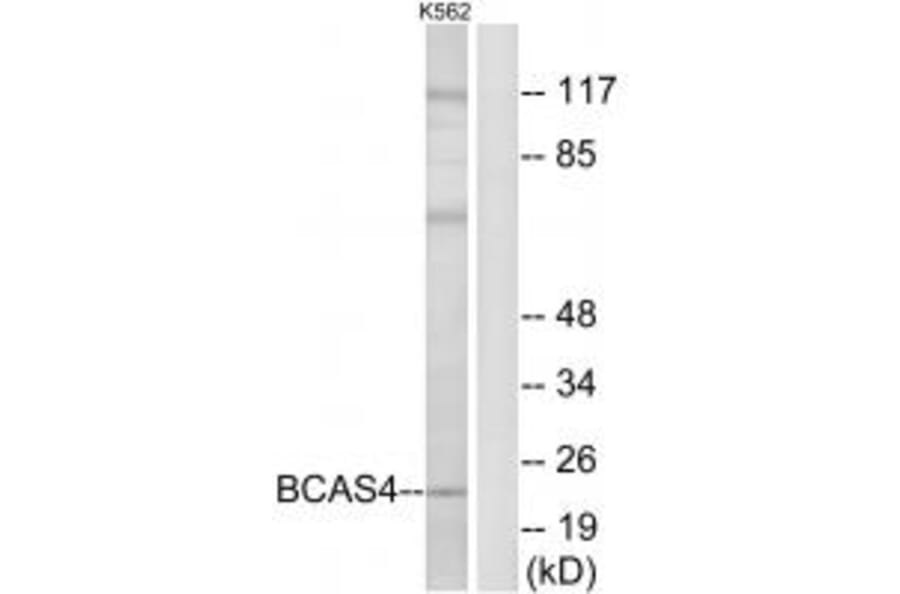 Western blot - BCAS4 Antibody from Signalway Antibody (34509) - Antibodies.com