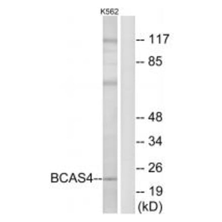 Western blot - BCAS4 Antibody from Signalway Antibody (34509) - Antibodies.com