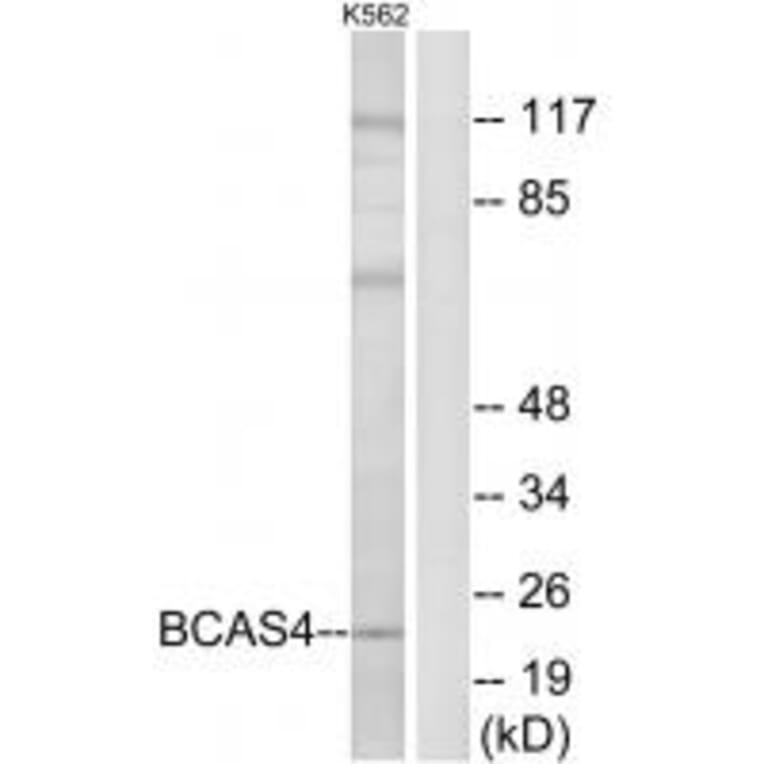 Western blot - BCAS4 Antibody from Signalway Antibody (34509) - Antibodies.com
