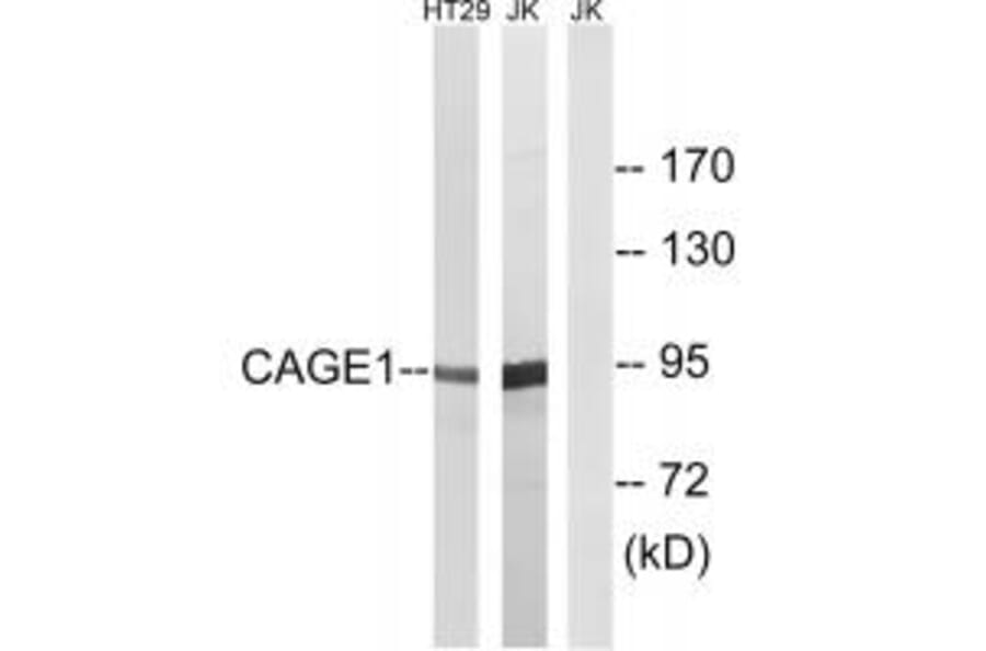 Western blot - CAGE1 Antibody from Signalway Antibody (34528) - Antibodies.com