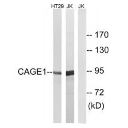 Western blot - CAGE1 Antibody from Signalway Antibody (34528) - Antibodies.com