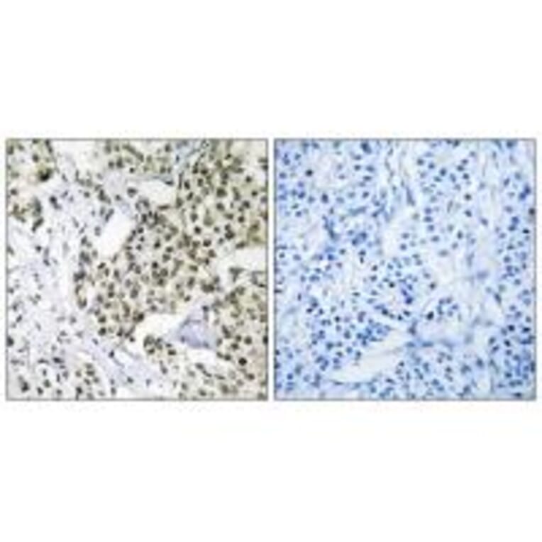 Immunohistochemistry - CAGE1 Antibody from Signalway Antibody (34528) - Antibodies.com