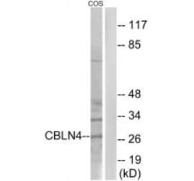Western blot - CBLN4 Antibody from Signalway Antibody (34573) - Antibodies.com