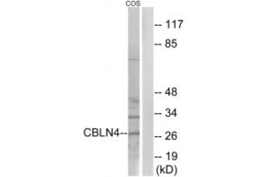 Western blot - CBLN4 Antibody from Signalway Antibody (34573) - Antibodies.com