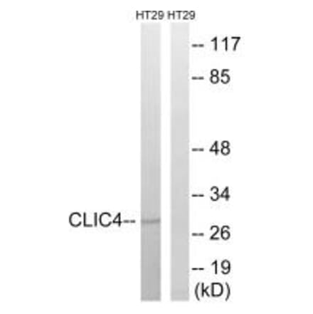 Western blot - CLIC4 Antibody from Signalway Antibody (34584) - Antibodies.com