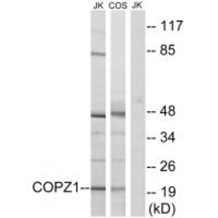 Western blot - COPZ1 Antibody from Signalway Antibody (34603) - Antibodies.com