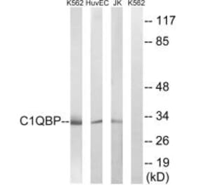 Western blot - C1QBP Antibody from Signalway Antibody (34611) - Antibodies.com