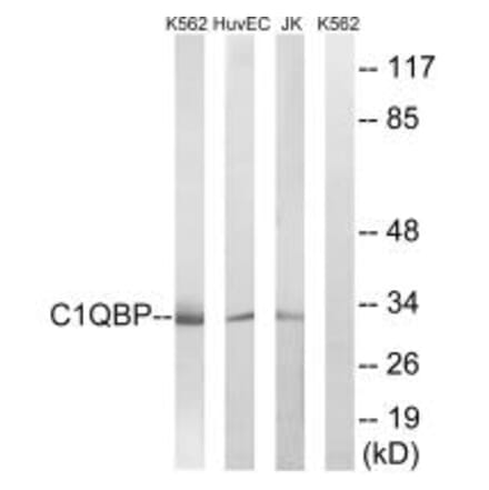 Western blot - C1QBP Antibody from Signalway Antibody (34611) - Antibodies.com
