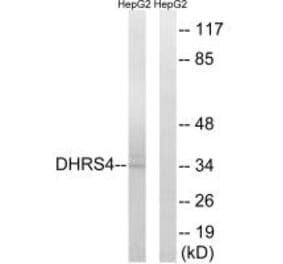 Western blot - DHRS4 Antibody from Signalway Antibody (34644) - Antibodies.com